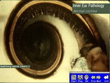 photo of normal cochlea
