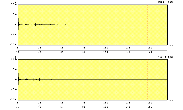 impulse response of anechoic room